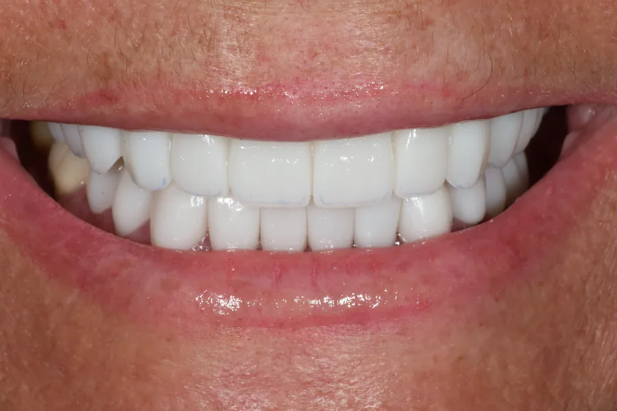 Complex restorative documentation After