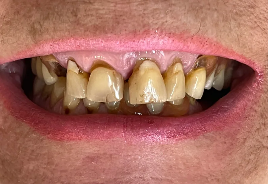 Complex restorative documentation Before