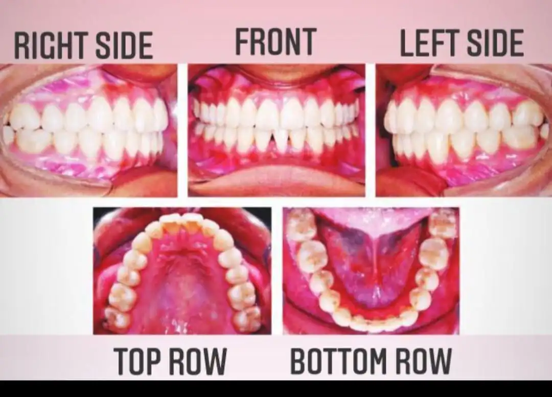 Smile photo guide for the influencer program